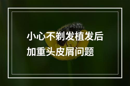 小心不剃发植发后加重头皮屑问题