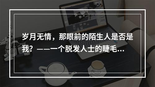 岁月无情，那眼前的陌生人是否是我？——一个脱发人士的睫毛移植经历