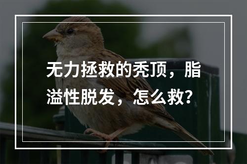 无力拯救的秃顶，脂溢性脱发，怎么救？