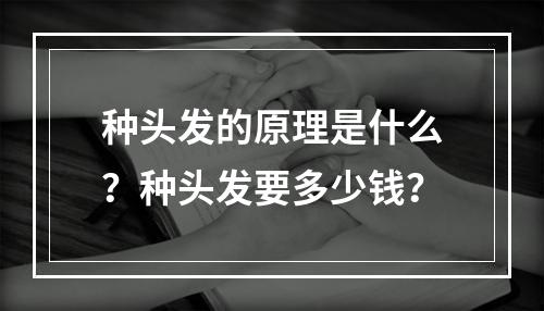 种头发的原理是什么？种头发要多少钱？