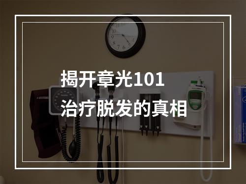 揭开章光101治疗脱发的真相