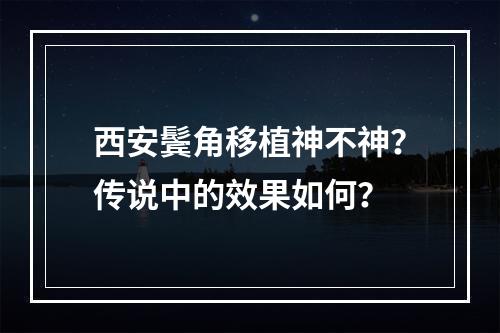 西安鬓角移植神不神？传说中的效果如何？