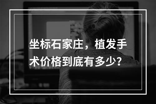 坐标石家庄，植发手术价格到底有多少？