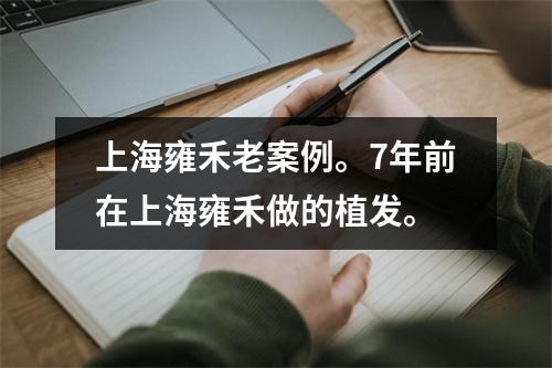 上海雍禾老案例。7年前在上海雍禾做的植发。