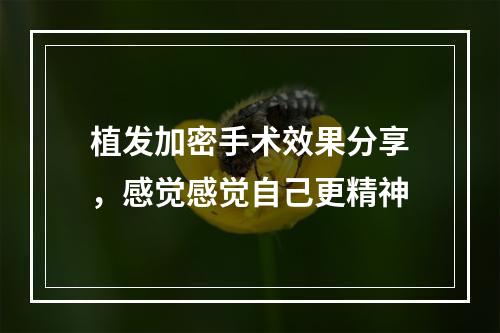 植发加密手术效果分享，感觉感觉自己更精神