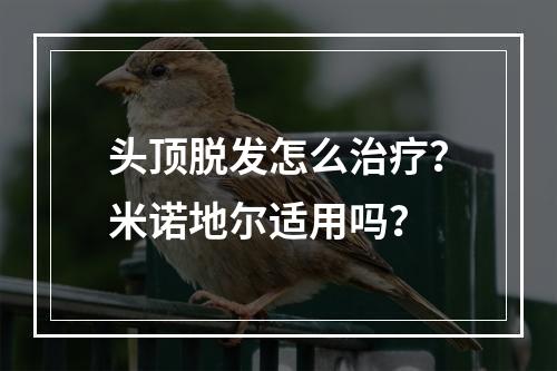 头顶脱发怎么治疗？米诺地尔适用吗？