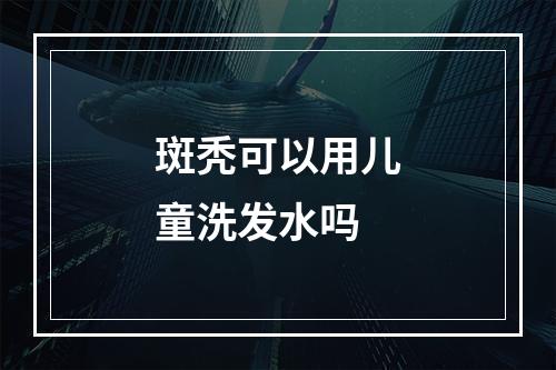 斑秃可以用儿童洗发水吗