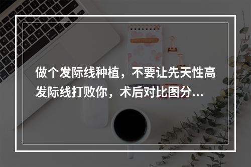 做个发际线种植，不要让先天性高发际线打败你，术后对比图分享