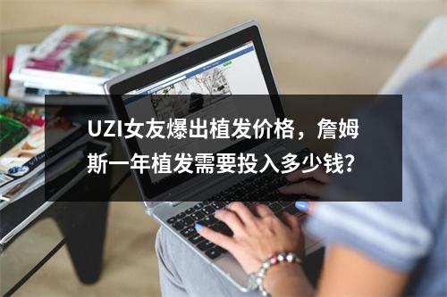 UZI女友爆出植发价格，詹姆斯一年植发需要投入多少钱？