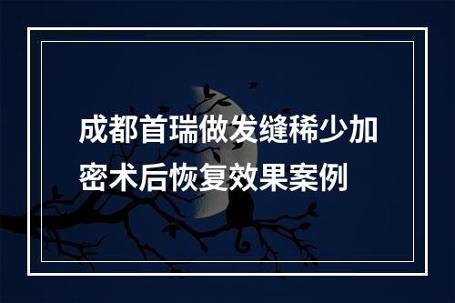 成都首瑞做发缝稀少加密术后恢复效果案例