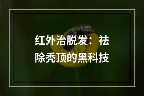 红外治脱发：祛除秃顶的黑科技