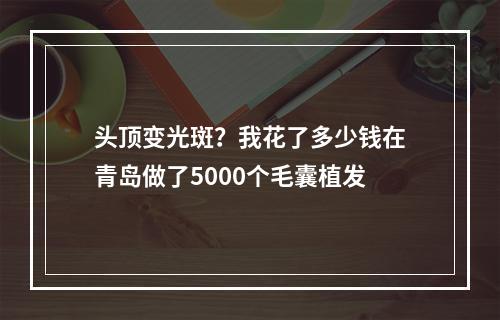 头顶变光斑？我花了多少钱在青岛做了5000个毛囊植发