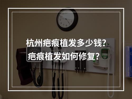 杭州疤痕植发多少钱？ 疤痕植发如何修复？