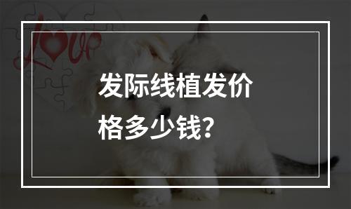 发际线植发价格多少钱？