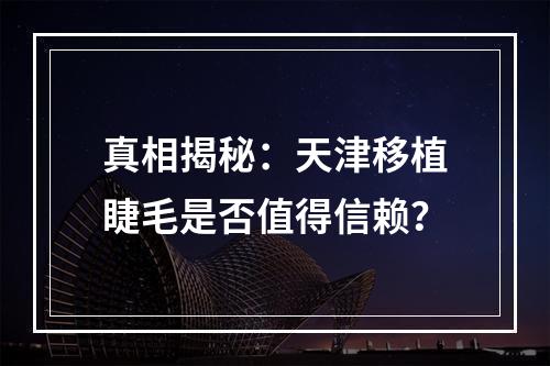 真相揭秘：天津移植睫毛是否值得信赖？