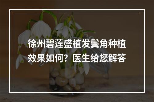 徐州碧莲盛植发鬓角种植效果如何？医生给您解答