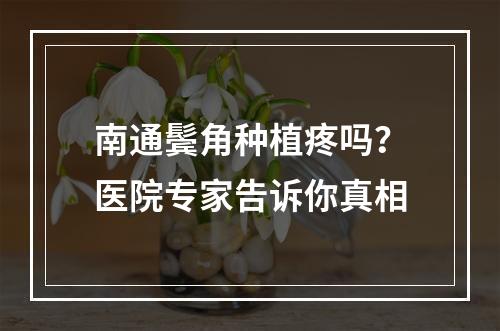 南通鬓角种植疼吗？医院专家告诉你真相