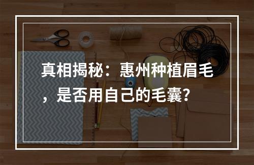 真相揭秘：惠州种植眉毛，是否用自己的毛囊？