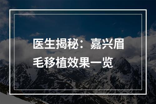 医生揭秘：嘉兴眉毛移植效果一览