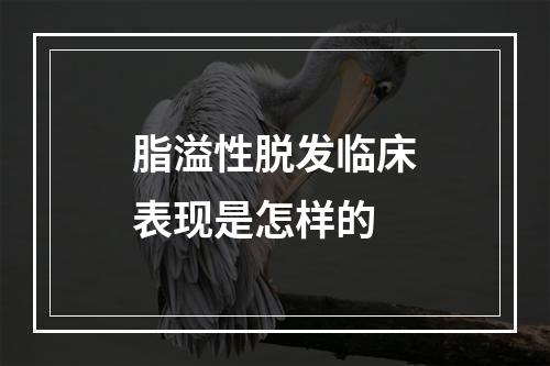 脂溢性脱发临床表现是怎样的