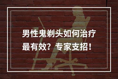 男性鬼剃头如何治疗最有效？专家支招！