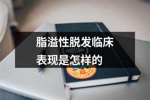 脂溢性脱发临床表现是怎样的