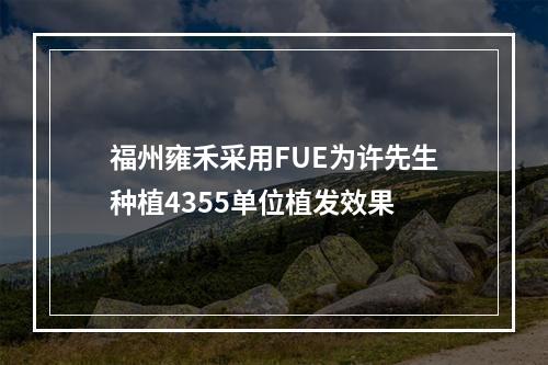 福州雍禾采用FUE为许先生种植4355单位植发效果