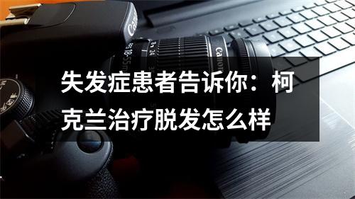 失发症患者告诉你：柯克兰治疗脱发怎么样