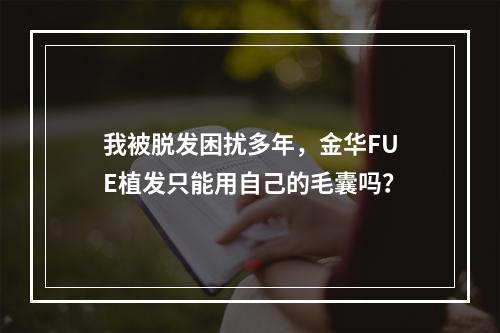 我被脱发困扰多年，金华FUE植发只能用自己的毛囊吗？