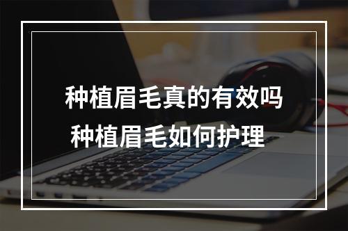 种植眉毛真的有效吗 种植眉毛如何护理