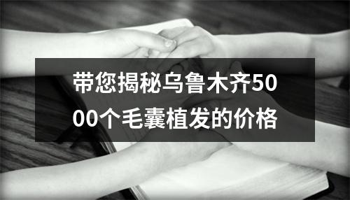 带您揭秘乌鲁木齐5000个毛囊植发的价格