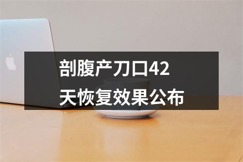 剖腹产刀口42天恢复效果公布