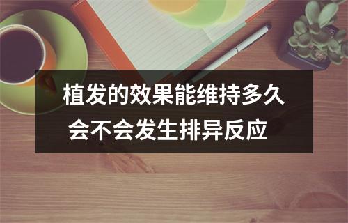 植发的效果能维持多久 会不会发生排异反应