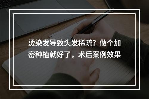 烫染发导致头发稀疏？做个加密种植就好了，术后案例效果