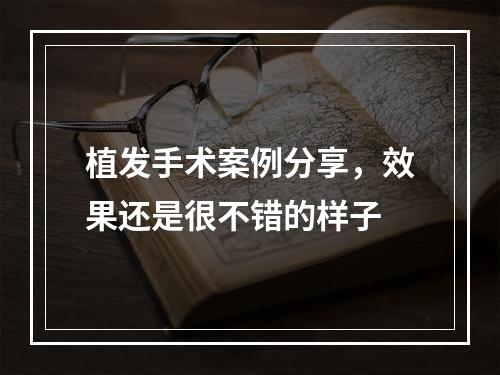 植发手术案例分享，效果还是很不错的样子