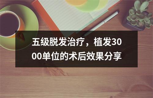 五级脱发治疗，植发3000单位的术后效果分享