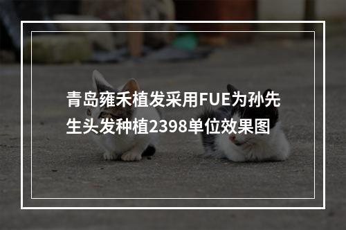 青岛雍禾植发采用FUE为孙先生头发种植2398单位效果图