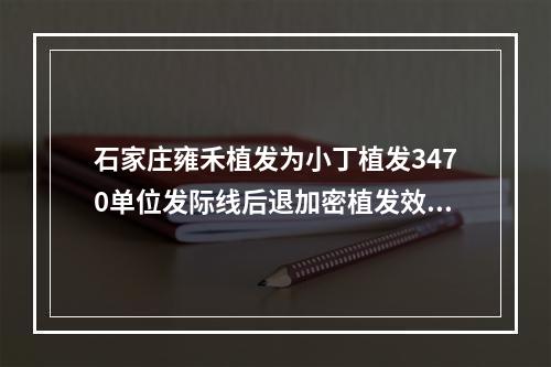 石家庄雍禾植发为小丁植发3470单位发际线后退加密植发效果