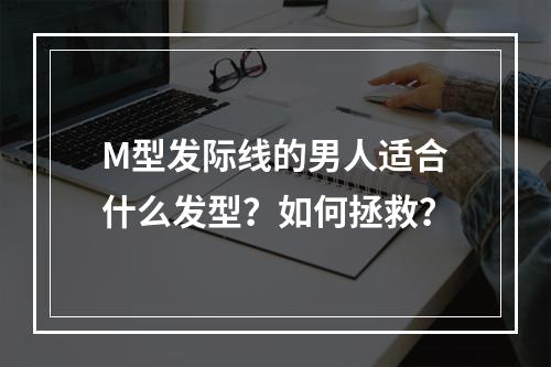 M型发际线的男人适合什么发型？如何拯救？