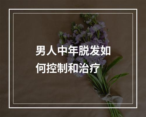 男人中年脱发如何控制和治疗