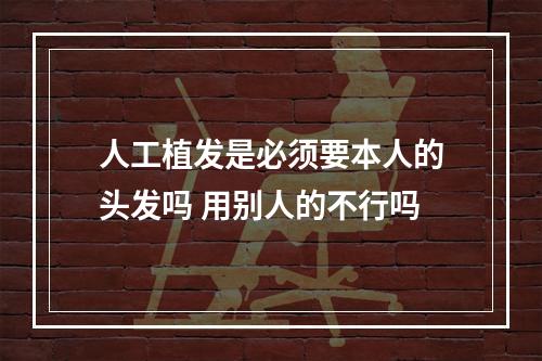 人工植发是必须要本人的头发吗 用别人的不行吗