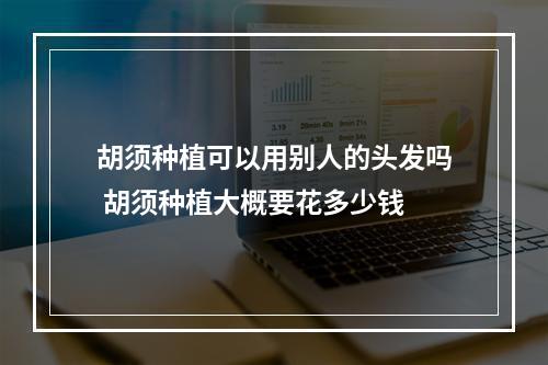 胡须种植可以用别人的头发吗 胡须种植大概要花多少钱