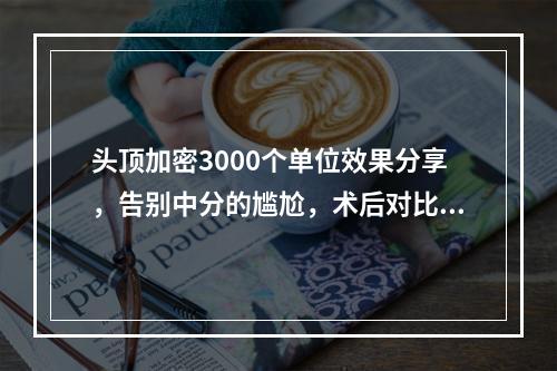 头顶加密3000个单位效果分享，告别中分的尴尬，术后对比图