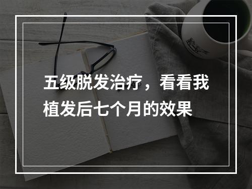 五级脱发治疗，看看我植发后七个月的效果