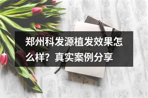 郑州科发源植发效果怎么样？真实案例分享