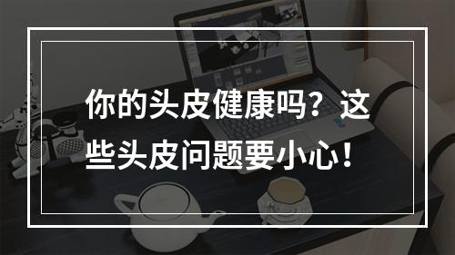 你的头皮健康吗？这些头皮问题要小心！