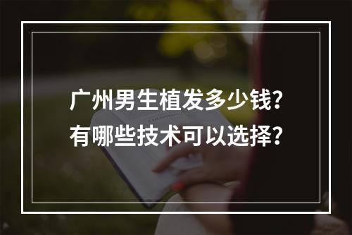 广州男生植发多少钱？有哪些技术可以选择？