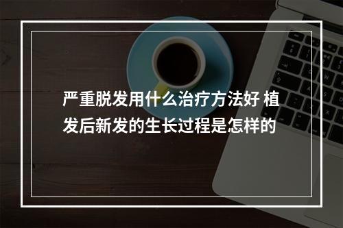 严重脱发用什么治疗方法好 植发后新发的生长过程是怎样的