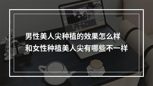 男性美人尖种植的效果怎么样 和女性种植美人尖有哪些不一样