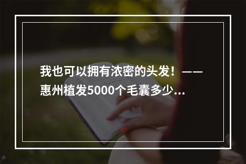 我也可以拥有浓密的头发！—— 惠州植发5000个毛囊多少钱一次啊